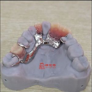 Dentaduras removibles <span class=keywords><strong>de</strong></span> alta calidad con marco <span class=keywords><strong>de</strong></span> metal y dientes acrílicos para prótesis dentales duraderas <span class=keywords><strong>Precio</strong></span> asequible - Product Image 6