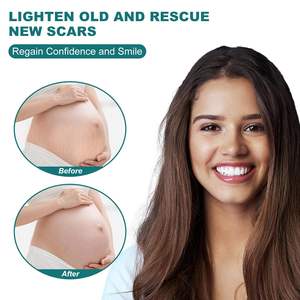 Cinta de Silicona de Grado Médico para Eliminar Cicatrices, Láminas Transparentes de Tela, Parche Antiarrugas para Cicatrices Quirúrgicas - 120 x 1.5 - Product Image 6