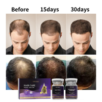 OEM/ODM Peptides Cellules Souches EGF Huile de Croissance Capillaire Nourrissante Réparatrice des Follicules Traitement Anti-Chute Sérum Ampoule pour la Repousse des Cheveux
