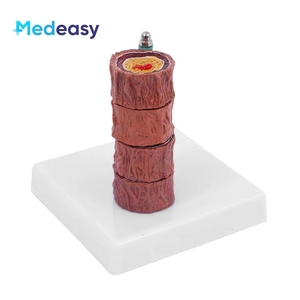 Modelo Anatómico Vascular de Cuatro Etapas de Medeasy Medical Science para el Estudio de la <span class=keywords><strong>Enfermedad</strong></span> de <span class=keywords><strong>Arteriosclerosis</strong></span> Humana - Product Image 2