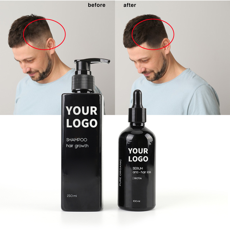OEM Best Biotin Hair Growth Shampoo