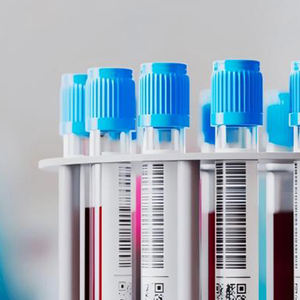 Klinischer Test Kunststoff-Fläschchen lagerung mit Forschungs glas Papier Biotechnologie Pharmazeut ische kryogene Etiketten Vinyl-Kunststoff röhrchen - Product Image 3