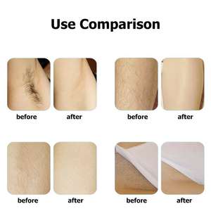 Fagioli di <span class=keywords><strong>cera</strong></span> dura naturale <span class=keywords><strong>per</strong></span> la depilazione <span class=keywords><strong>cera</strong></span> <span class=keywords><strong>depilatoria</strong></span> brasiliana liscia <span class=keywords><strong>per</strong></span> viso e corpo <span class=keywords><strong>per</strong></span> donna <span class=keywords><strong>uomo</strong></span> 500g - Product Image 5