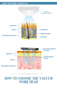 Appareil de soin de la peau à <span class=keywords><strong>injection</strong></span> d'oxygène 4 en 1 avec électricité BIO Photon pour le resserrement, le blanchiment et la revitalisation de la peau - Product Image 3