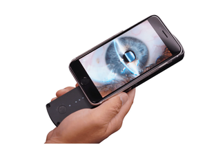 Lampe à fente portable InnoVue Opto PSL-150 avec garantie d'un an pour examen ophtalmique - Product Image 5
