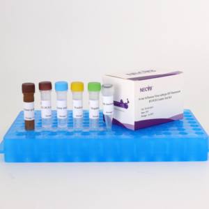 Kit de RT-PCR fluorescent universel pour grippe <span class=keywords><strong>aviaire</strong></span> H5 à double cible | Haute sensibilité pour H5N1/H5N8 et Pan-<span class=keywords><strong>Influenza</strong></span> A - Product Image 1