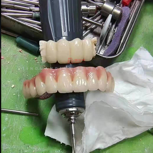 Implantes personalizados Solución de reemplazo dental Implantes dentales con el cuidado adecuado - Product Image 2