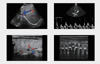 Appareil de diagnostic à ultrasons couleur sur chariot – Scanner d'échographie exclusif portable 3D/4D/5D – Équipement médical d'échographie