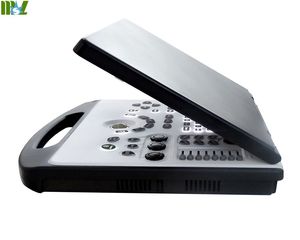 Scanner portátil de ultrassom para laptop, ultrassom doppler de cor melhor quanto máquina de ultrassom de drenagem - Product Image 4