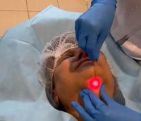Laser à fibre diode 980 nm Lipo Lipolyse Élimination de la graisse Endo Laser Liposuccion Machine de beauté laser