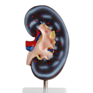 Modelo Anatómico de Riñón de 1 y 2 Partes para Demostración de Enfermedades, Herramienta de Enseñanza Médica, Modelo Médico - Product Image 6