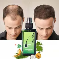 Spray de óleo para crescimento instantâneo do cabelo, anti-perda, de couro cabeludo, ervas, óleo para mulheres negras
