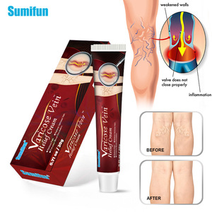 1 Pieza de Yeso Chino de 20g para <span class=keywords><strong>el</strong></span> Cuidado de la Piel, Crema para Várices, Eliminación de Arañas Vasculares, Ungüento para <span class=keywords><strong>el</strong></span> Dolor de Muslos, Hinchazón de Venas Corporales - Product Image 2