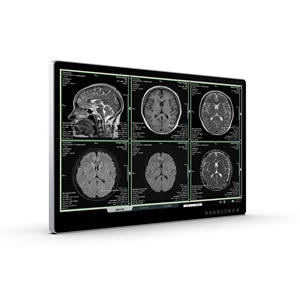 Monitor de endoscopia quirúrgica médica MD31 4K Ultra HD - Product Image 3