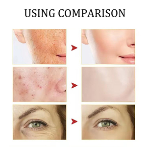 Kit de Productos para el Cuidado de la Piel con Logotipo Personalizado, Mucina de Caracol, Antienvejecimiento, Hidratante, Iluminador, Cosméticos de Belleza, Set para el Cuidado Facial - Product Image 5