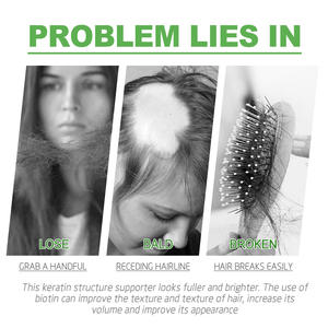 2025 Popular Hair Root Nutrient Moisturizing Hair Thickening Strengthening Ginger Germinal Oil - Product Image 3