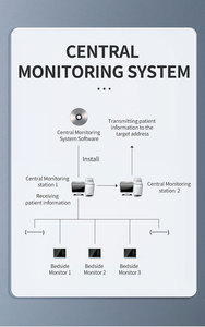 CONTEC CMS8000-1 <span class=keywords><strong>Monitor</strong></span> Pasien Portabel Multi-parameter Medis Elektrik 12,1 Inci 6-Parameter <span class=keywords><strong>Monitor</strong></span> Klinis Kelas II - Product Image 5