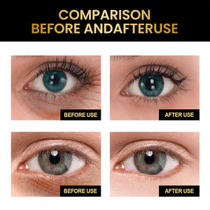 Özelleştirilmiş lüks havyar sıkılaştırıcı göz kırışıklık daire ve şişlik krem Anti Aging özel etiket ile göz kremi altında sopa - Product Image 5