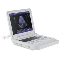 Appareil d'échocardiographie CONTEC CMS1700B Échocardiogramme Échographie Doppler couleur portable