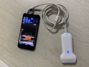 Cor animal sem fio doppler sonda linear ecocardiografia ultra-som máquina - Product Image 6