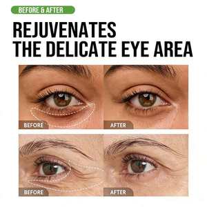 Crème hydratante pour les yeux à l'acide hyaluronique pour tous types de peau, hydratation 24 heures - Product Image 6