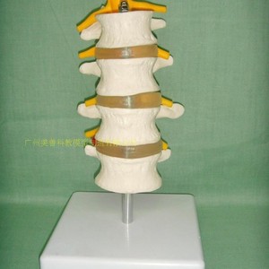 Vertèbres lombaires humaines en quatre segments ; modèle de vertèbres lombaires ; colonne vertébrale ; modèle de colonne vertébrale ; modèle de disque intervertébral lombaire. - Product Image 1