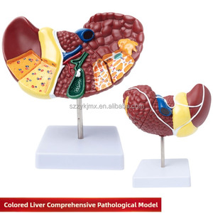 Modèle anatomique du foie pathologique humain pour l'école de médecine pour l'étude et la recherche sur les caractéristiques pathologiques du foie - Product Image 3