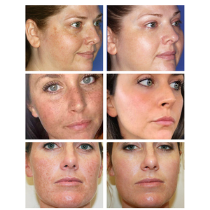 Produits professionnels de soins de la peau 2022, livraison directe, crème anti-rides pour le visage, lotion de soins de la peau - Product Image 3