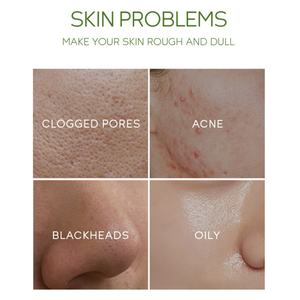 Mascarilla Facial de Arcilla para el Cuidado de la Piel con Logotipo Personalizado OEM, Mascarilla en Barra de Té Verde para Limpieza Profunda y Eliminación de Puntos Negros - Product Image 2