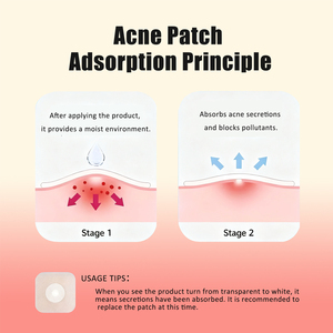 Jingda Acne Patches Hydrocolloid Plaster Pimple Master Invisible Face Repair Removing Makeup Sets <span class=keywords><strong>Treatment</strong></span> JD-AP04 2 Tahun - Product Image 5