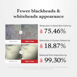 Medicube - Suero Exfoliante con Ácido Hipocloroso, 80 ml, Cuidado Facial Suave - Product Image 4