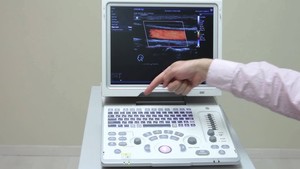 Sistema de Diagnóstico por Ultrasonido Doppler Color Portátil Mindray Z5, Adecuado para Aplicaciones Abdominales y Obstétricas/Ginecológicas. - Product Image 3