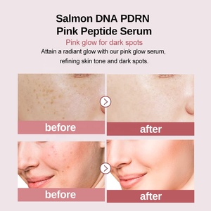 Salmón <span class=keywords><strong>DNA</strong></span> PDRN Pink Peptide Serum 1,01 Fl. Oz. Cuidado DE LA PIEL coreano, hidratante, reafirmante, antienvejecimiento, niacinamida para el hogar - Product Image 2