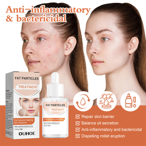 OUHOE 30ml Graisse Granule Effacement Peau Essence Éruption Miliaire Blanc Millet Papule Pustule Traitement Sérum Visage - Product Image 5