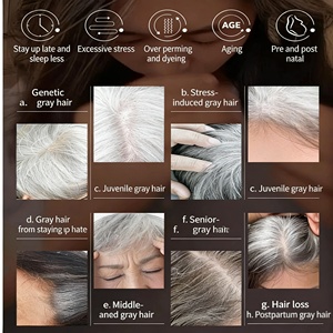 ผงสมุนไพรบำรุงหนังศีรษะ OEM ป้องกันผมหงอก บำรุงเส้นผม ลดการเกิดผมหงอกเป็นธรรมชาติ ช่วยฟื้นฟู<span class=keywords><strong>ผม</strong></span>ขาวให้กลับมาดำ - Product Image 6