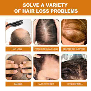 EELHOE Riz Dense Deep Clean Épais Hydratant Racine <span class=keywords><strong>Solide</strong></span> Soin des Cheveux Shampooing - Product Image 2