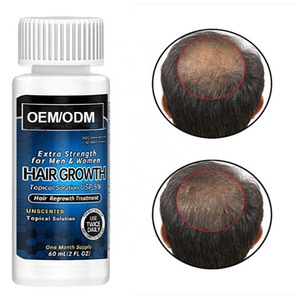 Suero <span class=keywords><strong>para</strong></span> <span class=keywords><strong>el</strong></span> Crecimiento del Cabello, Tratamiento Capilar Orgánico Personalizado OEM de 60 ml, 5% de Aceite <span class=keywords><strong>para</strong></span> <span class=keywords><strong>el</strong></span> Crecimiento del Cabello, Agente Nutritivo y Engrosador, Previene <span class=keywords><strong>la</strong></span> Caída del Cabello - Product Image 4