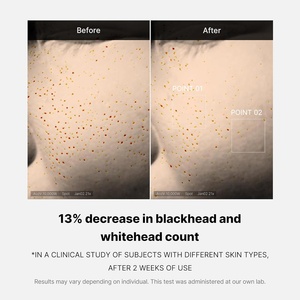 Sérum Nuit Réparateur Zéro Pores Medicube : Réduction Visible des Pores en une Seule Journée d'Utilisation - Product Image 4