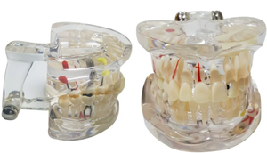 Modelo Dental de Dientes, Modelo de Dientes Transparente y Estándar para Enseñanza de Odontología, Demostración de Anatomía Oral - Product Image 3