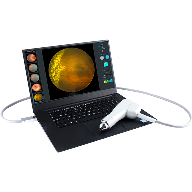 SY-v095 Ophthalmic Equipment Ophthalmology Adult Retinal Fundus Imaging Children Eye Retinal Fundus Camera