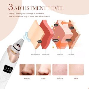 เครื่องดูดสิวเสี้ยนเทคโนโลยีใหม่ล่าสุดสำหรับดูแลผิวหน้า - Product Image 3