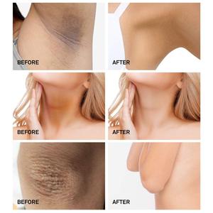 Crema Blanqueadora <span class=keywords><strong>VOVA</strong></span> para el Cuidado de la Piel del Cuerpo, Área Íntima, Vaginal, Axilas - Product Image 4