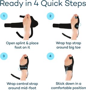 2-Pack Unisex Orthopedic Bunion Corrector Splint Hallux Valgus Pain Relief Adjustable <strong>Support</strong> Comfortable Hammer <strong>Toe</strong> - Product Image 6