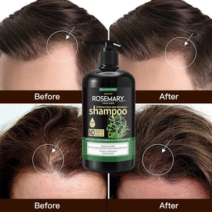 Haarpflege Anti-Schuppen Haarwuchs Bio Teebaumöl Rosmarin <span class=keywords><strong>Shampoo</strong></span> und Spülung - Product Image 4