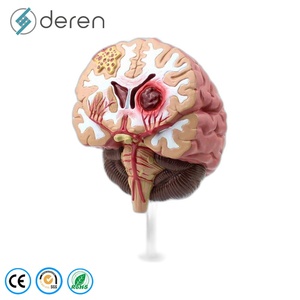 Modelo de Cerebro para Epilepsia Tipo Maniquí, Material PLA, para Hemorragia Cerebral, Malformación Arteriovenosa, Patología - Product Image 1