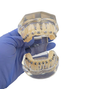 Modelo de Ortodoncia Typodont para Educación Dental con Brackets Metálicos y 28 Piezas Dentales - Product Image 4