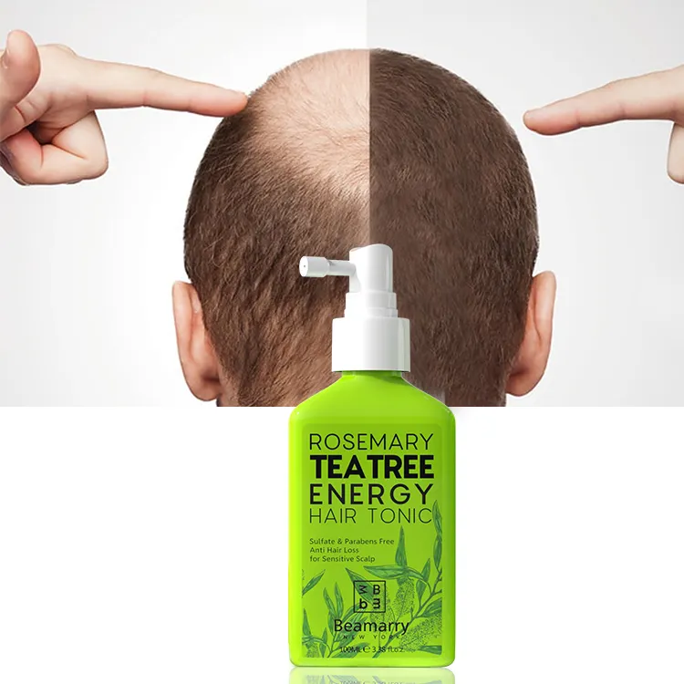Sulfat gebühr Private Label OEM Teebaumöl Haar wachstums spray Rosmarin Anti-Verlust Haarwuchs Tonic für empfindliche Kopfhaut