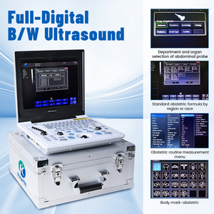 Sistema <span class=keywords><strong>de</strong></span> Diagnóstico por <span class=keywords><strong>Ultrasonido</strong></span> Completamente Digital en Blanco y Negro, Escáner <span class=keywords><strong>de</strong></span> <span class=keywords><strong>Ultrasonido</strong></span> B/N Hearto 120C con Pantalla LCD <span class=keywords><strong>de</strong></span> Alta Resolución <span class=keywords><strong>de</strong></span> 12 Pulgadas - Product Image 5