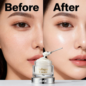 Crema Facial en Gel con Ácido Kójico, Crema Hidratante para la Piel, Elimina Manchas Oscuras, Suave para Piel Sensible - Product Image 5