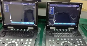 جهاز بحاسوب محمول طراز LANNX uRason E2 لأجهزة الموجات فوق الصوتية بالأبيض والأسود، جهاز ماسح للصوت الطبي للاستخدام البشري، جهاز الموجات فوق الصوتية المحمول